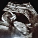 Salud, embarazo y curiosidad por el sexo del bebé