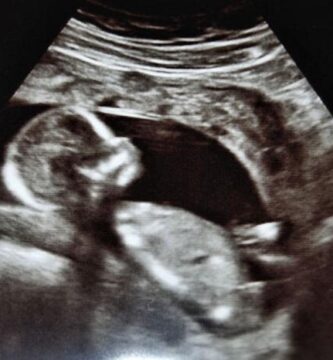 Salud, embarazo y curiosidad por el sexo del bebé